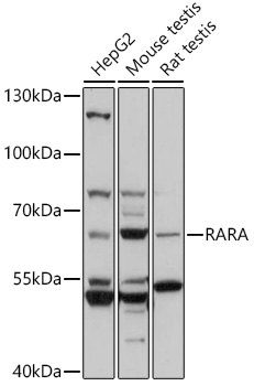 Anti-RARA Antibody (CAB0370)