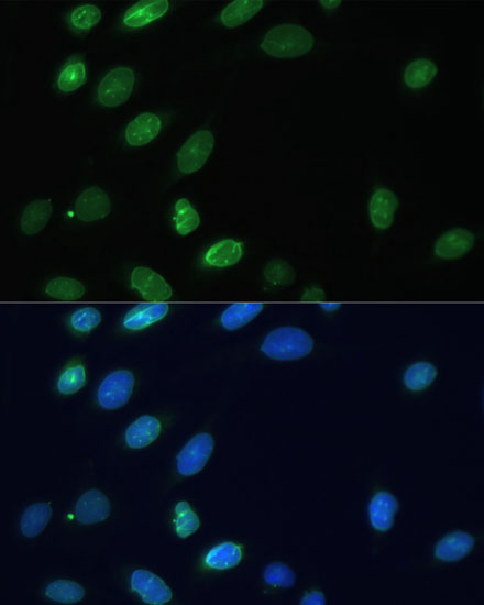 Anti-EMD Antibody (CAB13925)