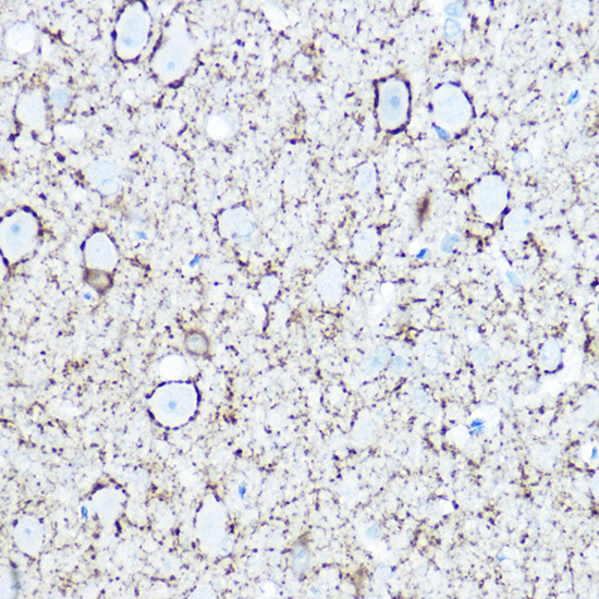 Anti-GAD1 Antibody (CAB2938)