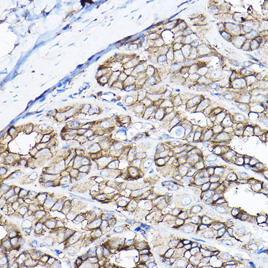 Anti-GNB2 Polyclonal Antibody (CAB8422)