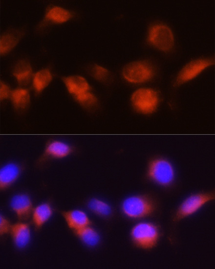 Anti-ACPP Antibody (CAB13457)