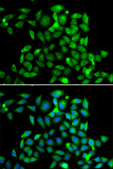 Anti-CLASP1 Antibody (CAB7081)