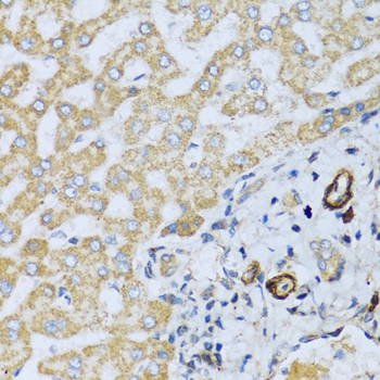 Anti-CSH1 Antibody (CAB1972)