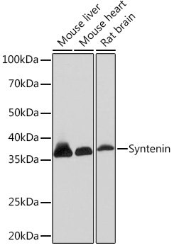 Anti-Syntenin Antibody (CAB5497)