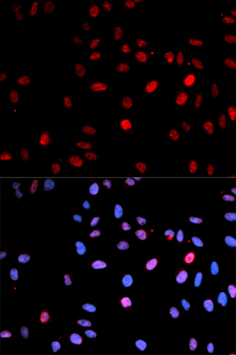 Anti-Phospho-p53-S15 Antibody (CABP0083)