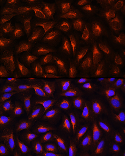 Anti-CRP Antibody (CAB0224)