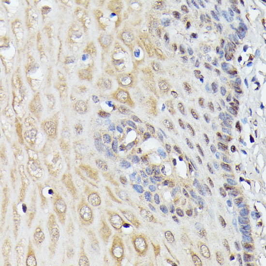 Anti-TRIP4 Antibody (CAB15352)