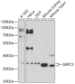 Anti-G6PC3 Antibody (CAB16234)