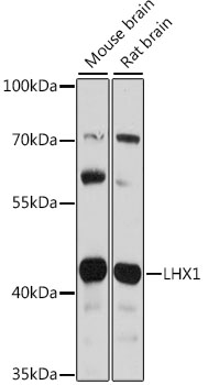 Anti-LHX1 Antibody (CAB16055)