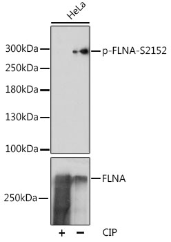 Anti-Phospho-FLNA-S2152 pAb (CABP0783)