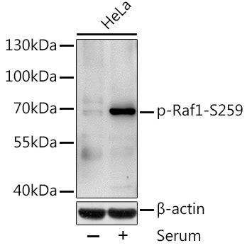 Anti-Phospho-RAF1-S259 Antibody (CABP0497)