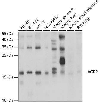 Anti-AGR2 Antibody (CAB7064)