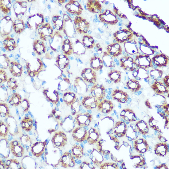 Anti-UQCRC1 Antibody (CAB3339)