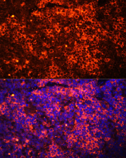 Anti-TLR8 Antibody (CAB1489)