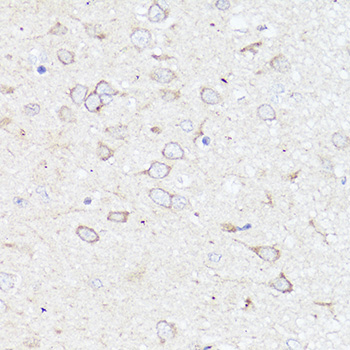 Anti-APP Antibody (CAB16265)