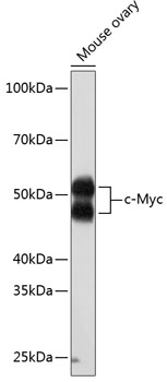 Anti-c-Myc Antibody [KO Validated] (CAB19032)