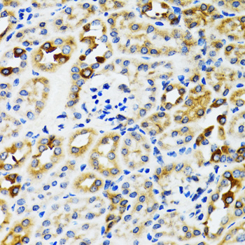 Anti-RPN1 Antibody (CAB12497)