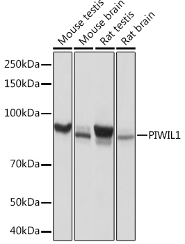 Anti-PIWIL-1 Rabbit Monoclonal Antibody (CAB3490)