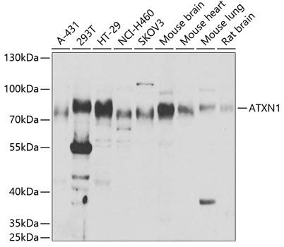 Anti-ATXN1 Antibody (CAB6217)