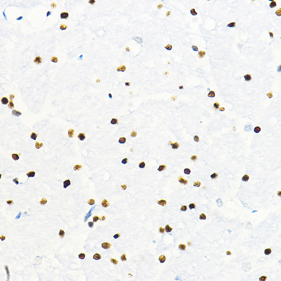 Anti-ZEB2 Antibody (CAB5705)