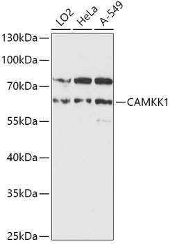 Anti-CAMKK1 Antibody (CAB16716)