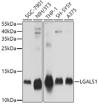 Anti-LGALS1 Antibody (CAB1580)