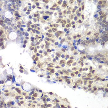 Anti-U2AF1 Antibody (CAB1046)