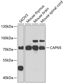 Anti-CAPN5 Antibody (CAB7428)