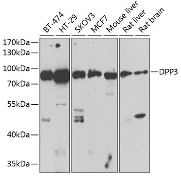 Anti-DPP3 Antibody (CAB13390)