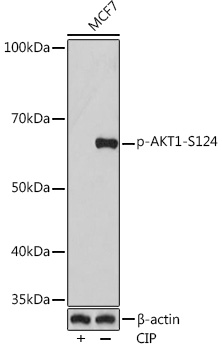 Anti-Phospho-AKT1-S124 Antibody (CABP0982)