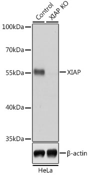 Anti-XIAP Antibody [KO Validated] (CAB6869)