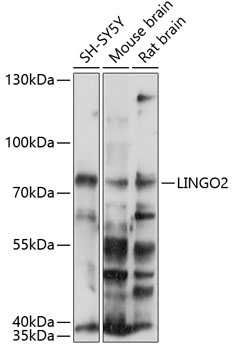 Anti-LINGO2 Antibody (CAB14968)