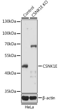 Anti-CSNK1E Antibody [KO Validated] (CAB1796)