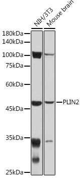 Anti-PLIN2 Antibody (CAB6276)