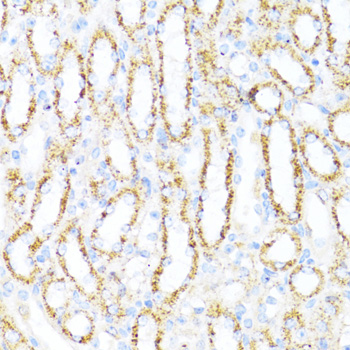 Anti-ALDH6A1 Antibody (CAB14750)