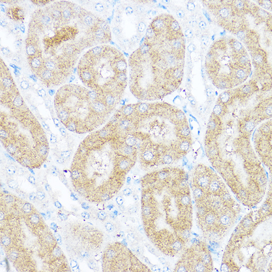 Anti-SORD Antibody (CAB2118)