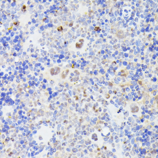 Anti-MLF2 Antibody (CAB16076)