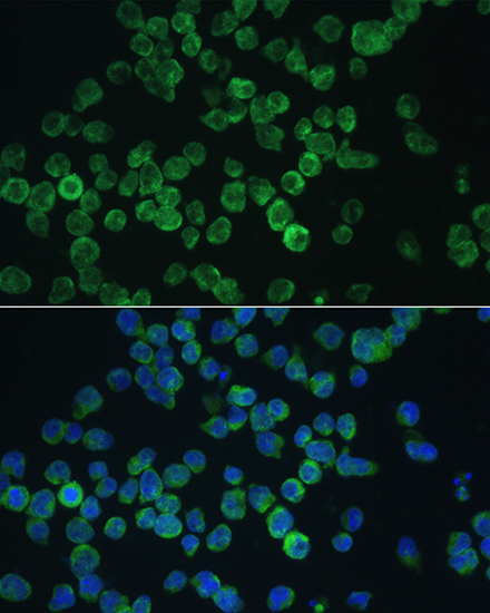 Anti-RIPK3 Antibody (CAB12996)