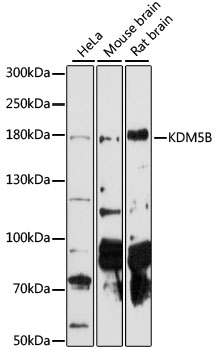 Anti-JARID1B Antibody (CAB14104)