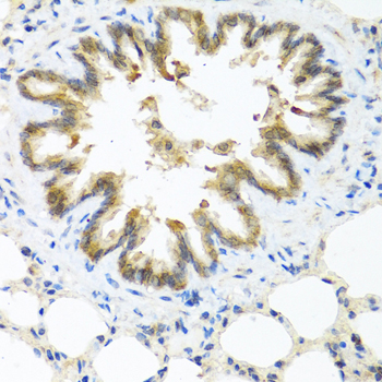 Anti-S100A7 Antibody (CAB1940)