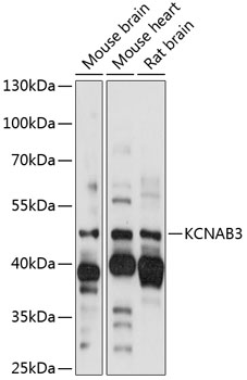 Anti-KCNAB3 Antibody (CAB14822)