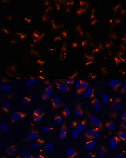 Anti-CCDC47 Antibody (CAB15871)