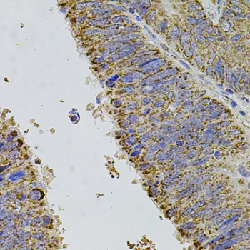 Anti-ALDH1A1 Antibody (CAB1802)