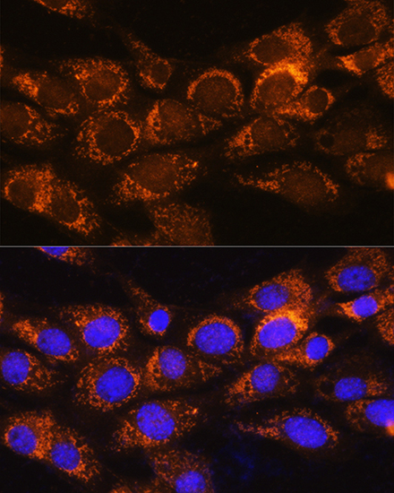 Anti-BCKDHA Polyclonal Antibody (CAB9806)