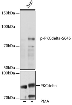 Anti-Phospho-PKCdelta-S645 Antibody (CABP0972)