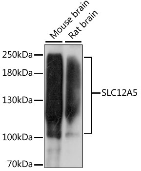 Anti-SLC12A5 Antibody (CAB15486)