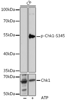 Anti-Phospho-CHEK1-S345 Antibody (CABP0578)