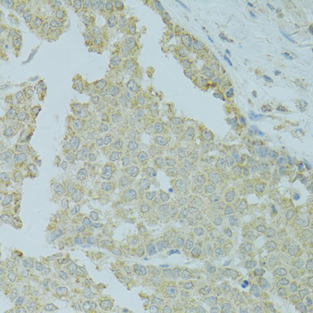 Anti-MTFP1 Antibody (CAB7110)