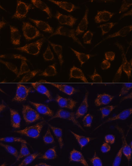 Anti-GTPBP8 Antibody (CAB16189)