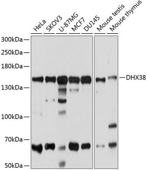 Anti-DHX38 Antibody (CAB4341)